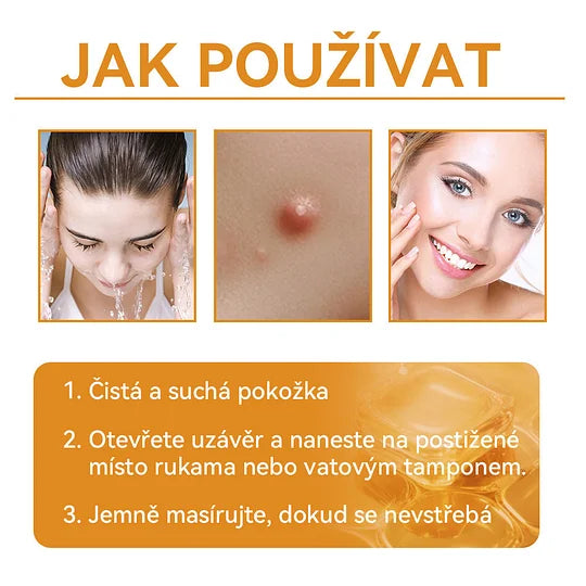 💥🔥𝐕o𝐬𝐨𝐱𝐚™ 𝐕č𝐞𝐥í𝐦 𝐉𝐞𝐝𝐞𝐦 𝐍𝐚 𝐎𝐝𝐬𝐭𝐫𝐚𝐧ě𝐧í 𝐁𝐫𝐚𝐝𝐚𝐯𝐢𝐜 𝐀 𝐙𝐧𝐚𝐦é𝐧𝐞𝐤 𝐊𝐫é𝐦🐝🐝(🔥𝐏𝐫𝐨𝐩𝐚𝐠𝐚č𝐧í 𝐚𝐤𝐜𝐞 𝐧𝐚 𝐩𝐨𝐬𝐥𝐞𝐝𝐧í 𝐝𝐞𝐧 𝟖𝟎% 𝐬𝐥𝐞𝐯𝐚)🔥💥✨