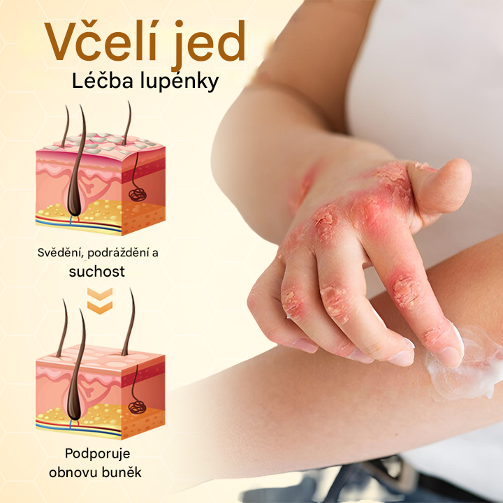 Timilk® BeeLieve Péče o pokožku s lupénkou🐝