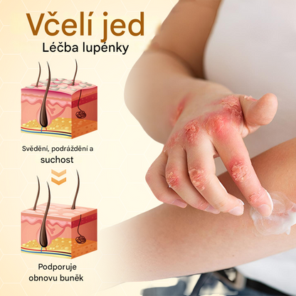 Timilk® BeeLieve Péče o pokožku s lupénkou🐝