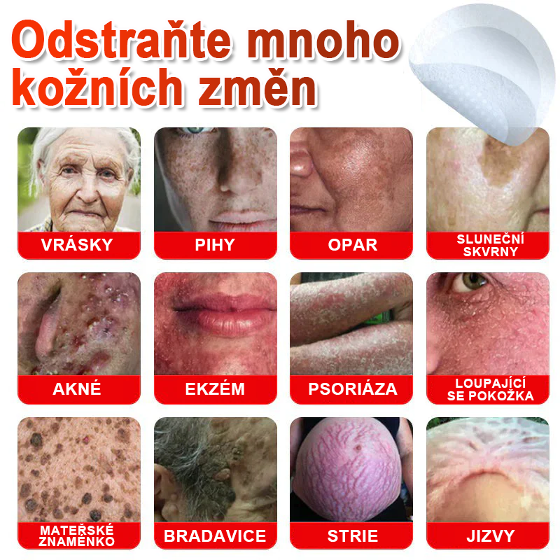 TLOPA® Mikrovpichová botanická náplast na odstranění kožních výrůstků 🇨🇿 Vyrobeno v Česká republika💥