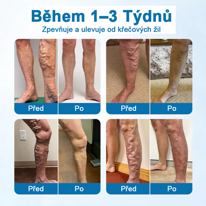 Timilk® VeinGuard bylinný sprej – ✅ Klinicky prokázáno, že odstraní křečové žíly za pouhých 7 dní!💥💥