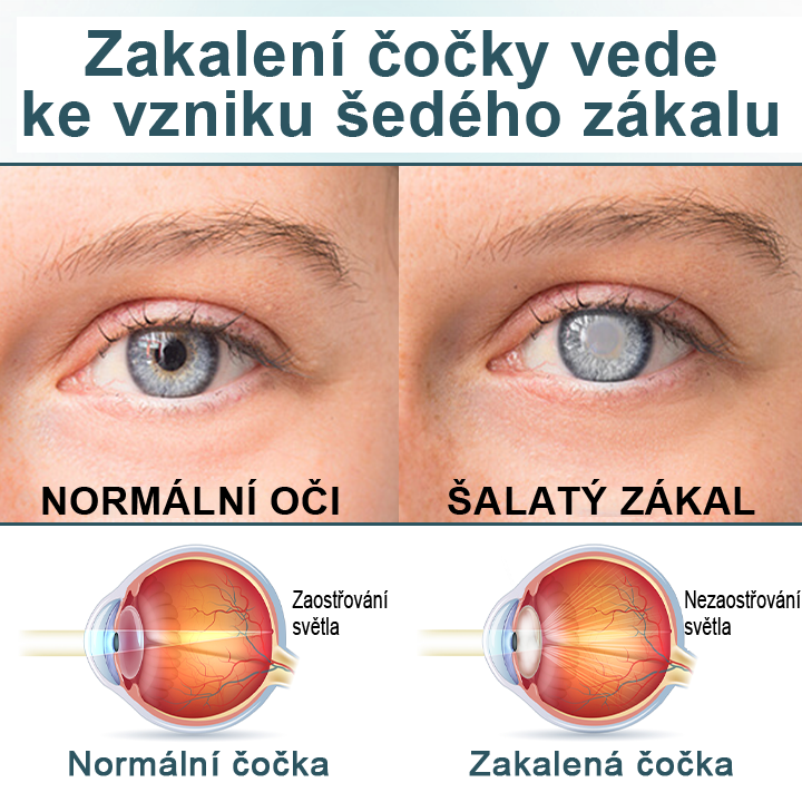 Timilk® OptiFusion Nano oční sérum ve formě kapek