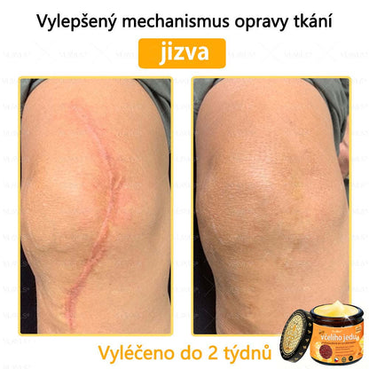 Foulme® Profesionální krém na odstranění včelího jedu🐝