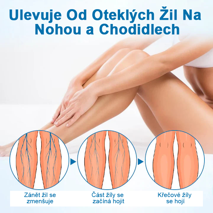 Timilk® VeinGuard bylinný sprej – ✅ Klinicky prokázáno, že odstraní křečové žíly za pouhých 7 dní!💥💥