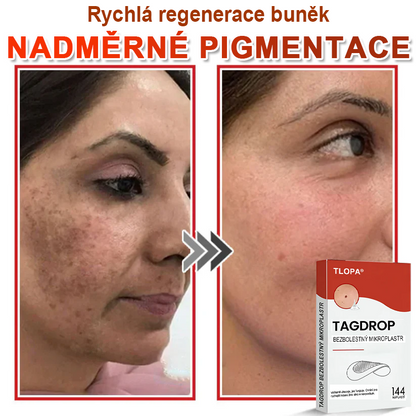 TLOPA® Mikrovpichová botanická náplast na odstranění kožních výrůstků 🇨🇿 Vyrobeno v Česká republika💥