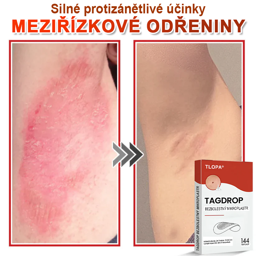 TLOPA® Mikrovpichová botanická náplast na odstranění kožních výrůstků 🇨🇿 Vyrobeno v Česká republika💥
