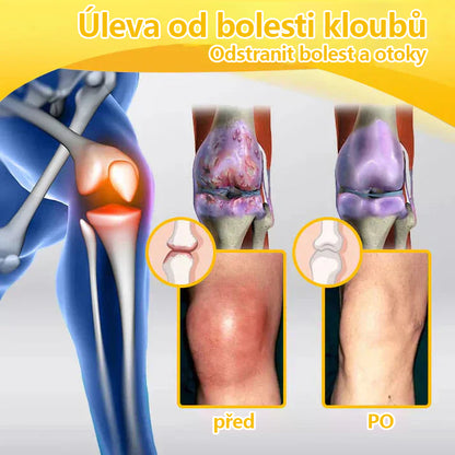 🔥💫Ourlyard™ Hořčíkový olej a včelí jed na hojení kloubů ve spreji👨‍⚕️Cure bolesti kloubů za pouhé 4 týdny, bez zpětného efektu