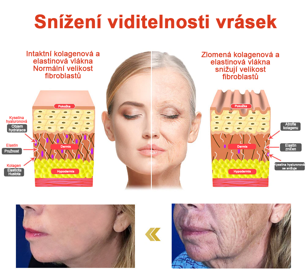 𝗦𝗧𝗗𝗘𝗜™ Zázračný luxusní tělový olej (Časově omezená sleva 80 % - poslední 1 den)🌹🔥