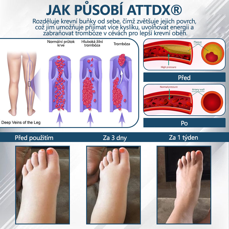 Cvreoz® Černý kmín Edema Detoxikační bylinný krém