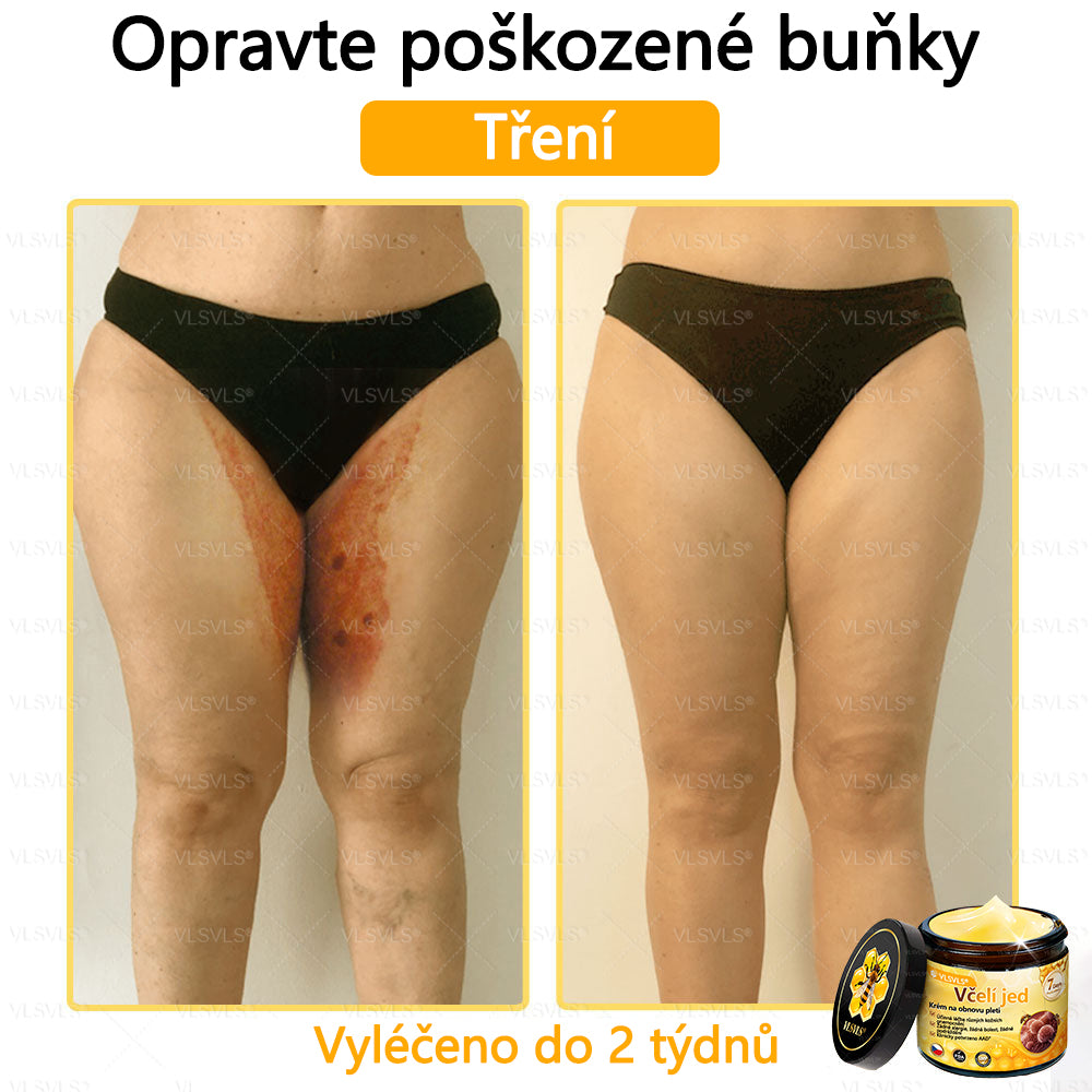 ✅VLSVLS™ Obnovující krém se včelím jedem🐝💥💥