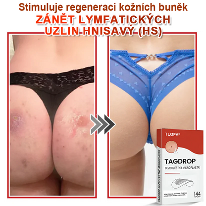 TLOPA® Mikrovpichová botanická náplast na odstranění kožních výrůstků 🇨🇿 Vyrobeno v Česká republika💥