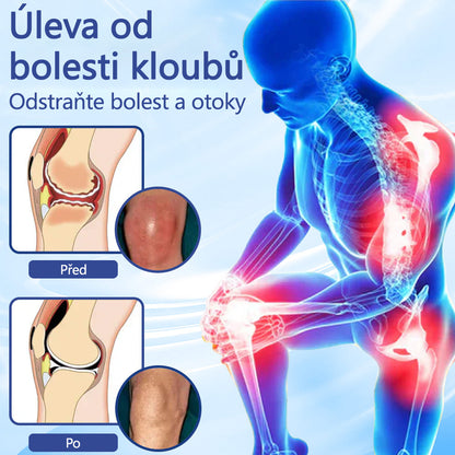 ✅ Schváleno MZČR lékaři | Ourlyard® Hořčíkový krém na úlevu od bolesti kostí a svalů ( Pro artritidu, neuropatii, revmatická onemocnění, svalové křeče, záškuby i sportovní úrazy)