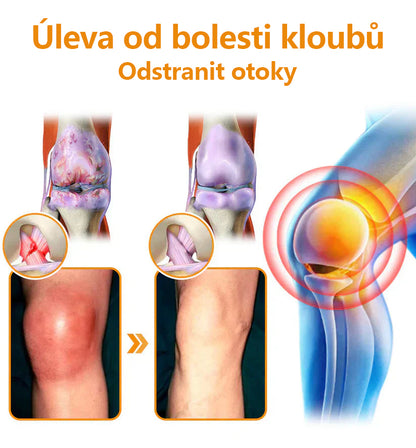 🔥💫Ourlyard™ Hořčíkový olej a včelí jed na hojení kloubů ve spreji👨‍⚕️Cure bolesti kloubů za pouhé 4 týdny, bez zpětného efektu