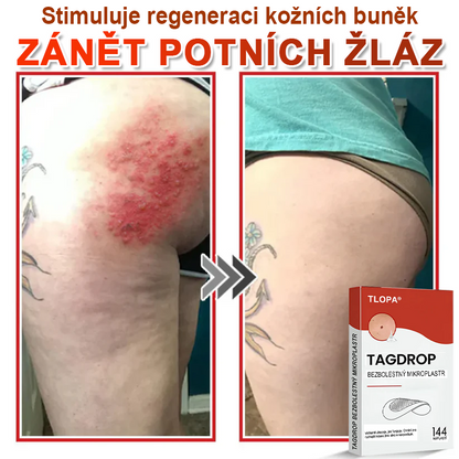 TLOPA® Mikrovpichová botanická náplast na odstranění kožních výrůstků 🇨🇿 Vyrobeno v Česká republika💥