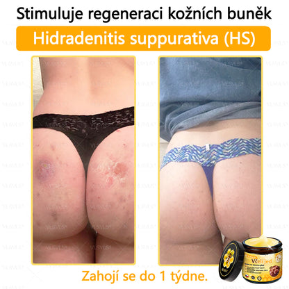 ✅VLSVLS™ Obnovující krém se včelím jedem🐝💥💥