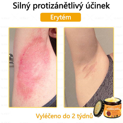 Foulme® Profesionální krém na odstranění včelího jedu🐝