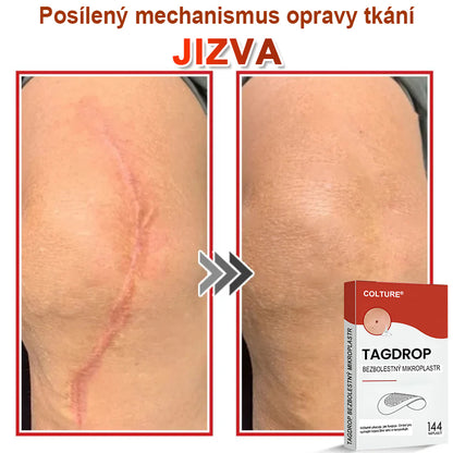 COLTURE® Mikrovpichová botanická náplast na odstranění kožních výrůstků