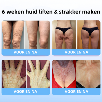 🔥🔥vyhledávaný produkt!Sleva na poslední den: 𝟕5% sleva🎉𝐅𝐮𝐛𝐬𝐭𝐚® Pokročilý krém na zpevnění a redukci vrásek: Obnovení pružnosti pleti - 2024🔥🔥🥰