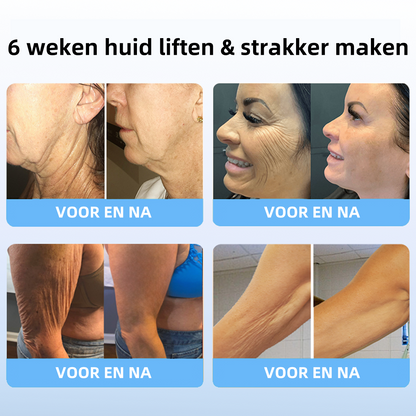 🔥🔥vyhledávaný produkt!Sleva na poslední den: 𝟕5% sleva🎉𝐅𝐮𝐛𝐬𝐭𝐚® Pokročilý krém na zpevnění a redukci vrásek: Obnovení pružnosti pleti - 2024🔥🔥🥰