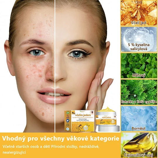 💥🔥𝐕o𝐬𝐨𝐱𝐚™ 𝐕č𝐞𝐥í𝐦 𝐉𝐞𝐝𝐞𝐦 𝐍𝐚 𝐎𝐝𝐬𝐭𝐫𝐚𝐧ě𝐧í 𝐁𝐫𝐚𝐝𝐚𝐯𝐢𝐜 𝐀 𝐙𝐧𝐚𝐦é𝐧𝐞𝐤 𝐊𝐫é𝐦🐝🐝(🔥𝐏𝐫𝐨𝐩𝐚𝐠𝐚č𝐧í 𝐚𝐤𝐜𝐞 𝐧𝐚 𝐩𝐨𝐬𝐥𝐞𝐝𝐧í 𝐝𝐞𝐧 𝟖𝟎% 𝐬𝐥𝐞𝐯𝐚)🔥💥✨