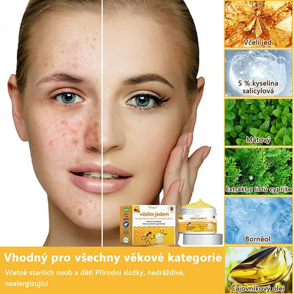 💥🔥𝐕o𝐬𝐨𝐱𝐚™ 𝐕č𝐞𝐥í𝐦 𝐉𝐞𝐝𝐞𝐦 𝐍𝐚 𝐎𝐝𝐬𝐭𝐫𝐚𝐧ě𝐧í 𝐁𝐫𝐚𝐝𝐚𝐯𝐢𝐜 𝐀 𝐙𝐧𝐚𝐦é𝐧𝐞𝐤 𝐊𝐫é𝐦🐝🐝(🔥𝐏𝐫𝐨𝐩𝐚𝐠𝐚č𝐧í 𝐚𝐤𝐜𝐞 𝐧𝐚 𝐩𝐨𝐬𝐥𝐞𝐝𝐧í 𝐝𝐞𝐧 𝟖𝟎% 𝐬𝐥𝐞𝐯𝐚)🔥💥✨