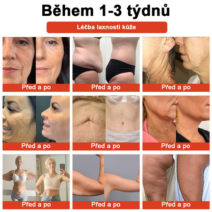 𝗦𝗧𝗗𝗘𝗜™ Zázračný luxusní tělový olej (Časově omezená sleva 80 % - poslední 1 den)🌹🔥