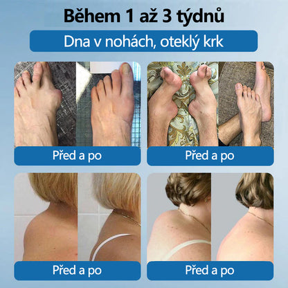 Lékárna Na Poště | Foulme® BPC-157 Regenerační krém na klouby 🦴 Léčí artritidu, neuropatii, revmatismus, sportovní zranění a další potíže 👍