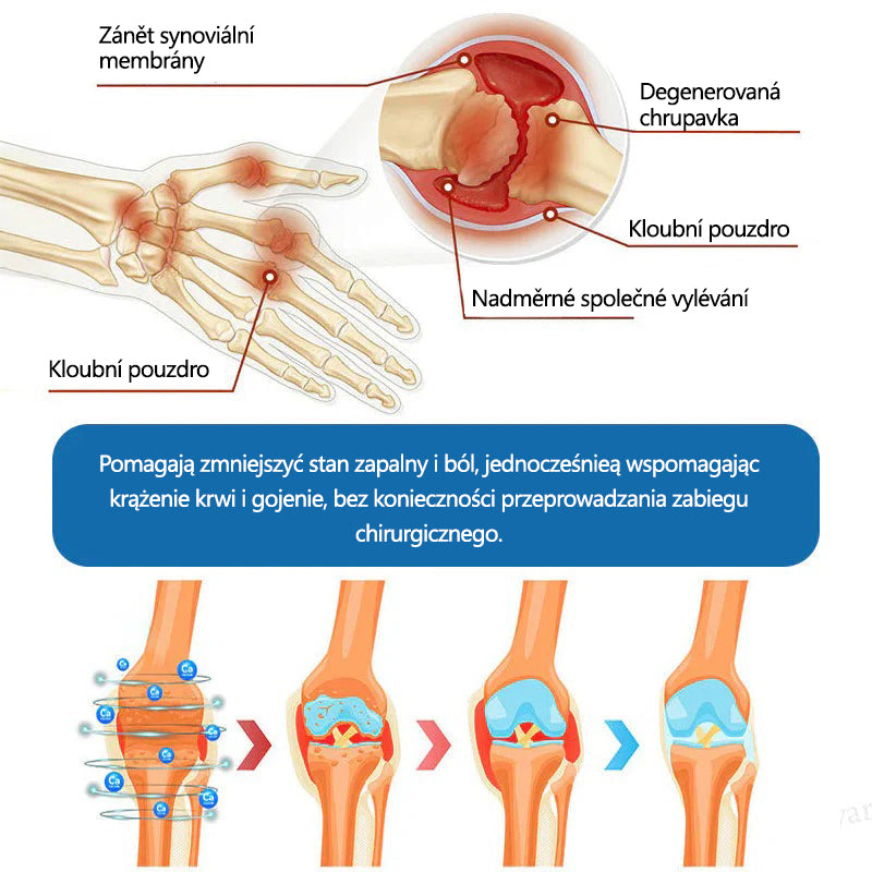 Lékárna Na Poště | Foulme® BPC-157 Regenerační krém na klouby 🦴 Léčí artritidu, neuropatii, revmatismus, sportovní zranění a další potíže 👍