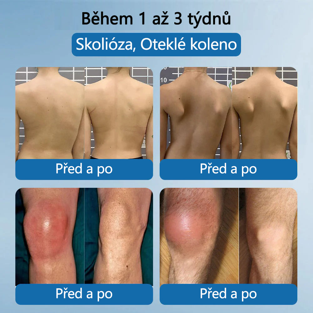 Lékárna Na Poště | Foulme® BPC-157 Regenerační krém na klouby 🦴 Léčí artritidu, neuropatii, revmatismus, sportovní zranění a další potíže 👍