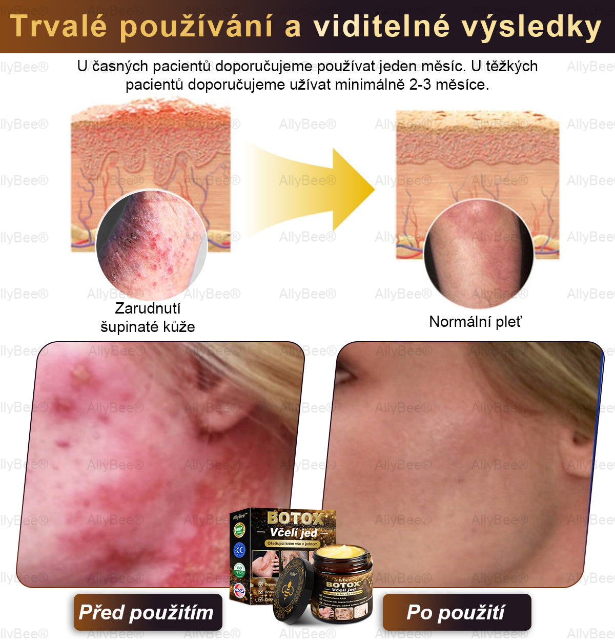 👨‍🔬AllyBee® Botox Krém na ošetření pleti proti stárnutí, hydratační, oprava pleti, vyrovnání tónu pleti, léčba akné a tmavých skvrn, odstraňování bradavic a mateřských znamének