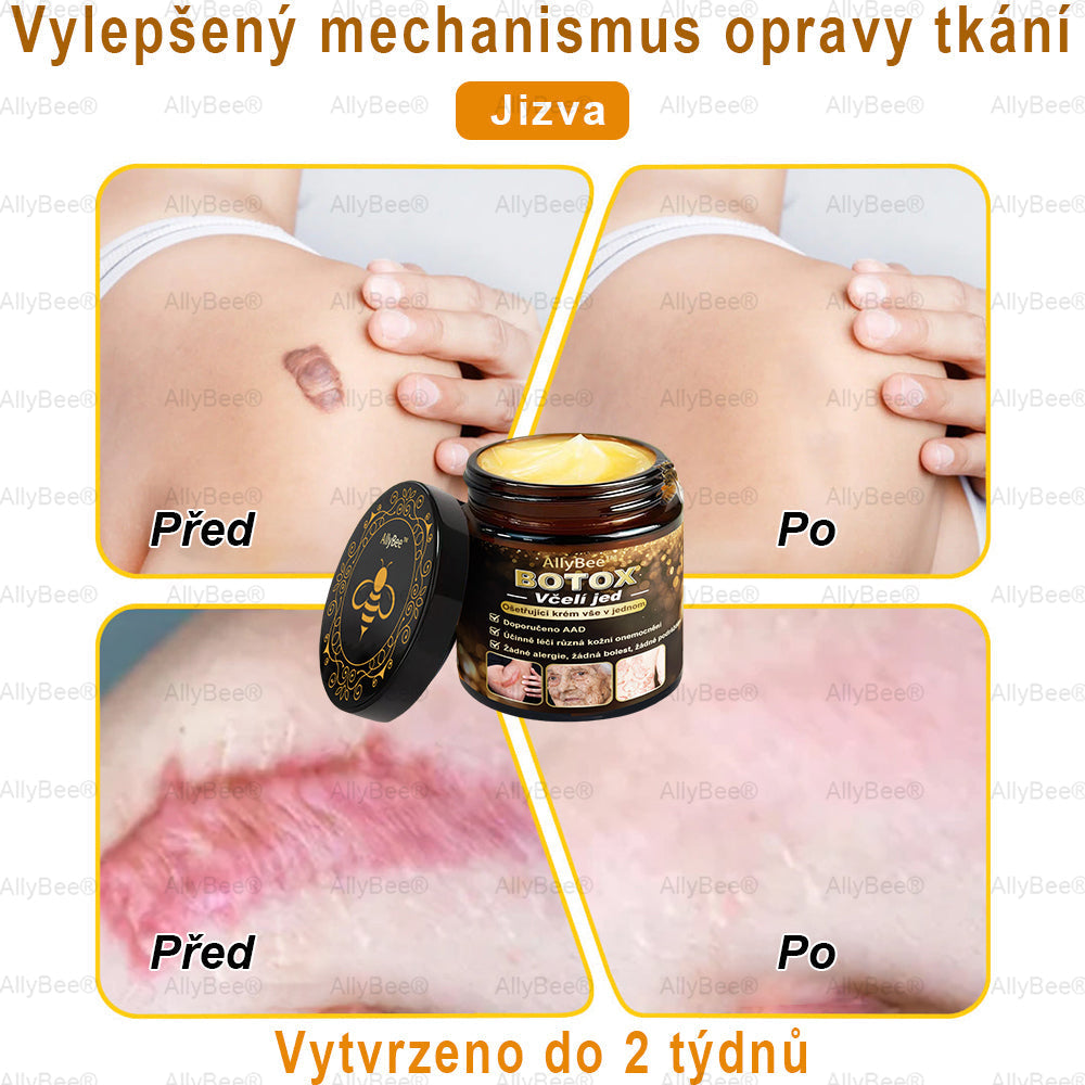 👨‍🔬AllyBee® Botox Krém na ošetření pleti proti stárnutí, hydratační, oprava pleti, vyrovnání tónu pleti, léčba akné a tmavých skvrn, odstraňování bradavic a mateřských znamének