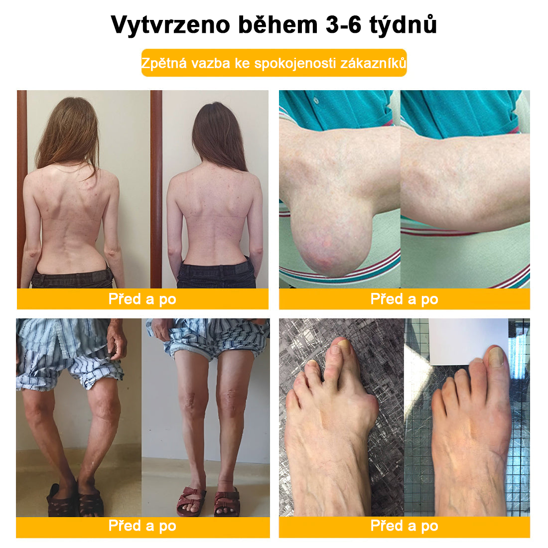 𝑭𝑨𝑻𝑶𝑵𝑮® Krém proti bolesti a hojení kostí ze včelího jedu (Výhradně pro seniory a na doporučení NVOC)🧨