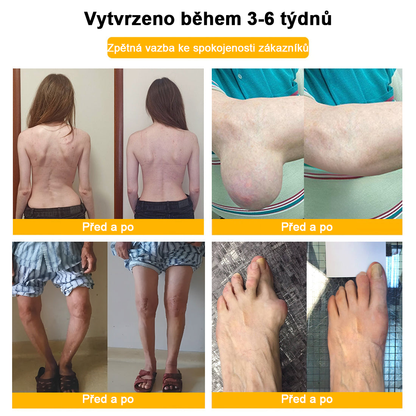 𝑭𝑨𝑻𝑶𝑵𝑮® Krém proti bolesti a hojení kostí ze včelího jedu (Výhradně pro seniory a na doporučení NVOC)🧨