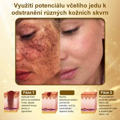👨‍🔬AllyBee® Botox Krém na ošetření pleti proti stárnutí, hydratační, oprava pleti, vyrovnání tónu pleti, léčba akné a tmavých skvrn, odstraňování bradavic a mateřských znamének