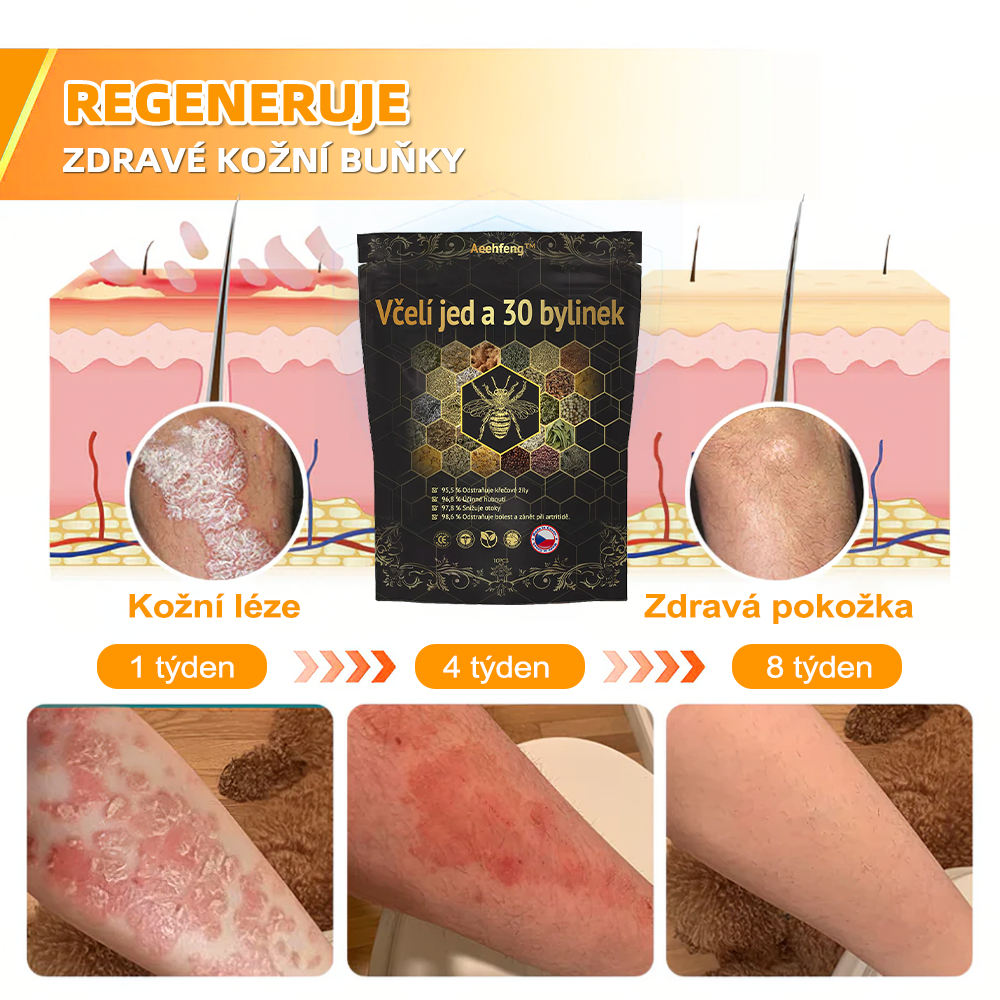 🔥💫 Poslední den na získání slevy 70 %: Aeehfeng®  Včelí jed a 30 bylinek pro detoxikaci nohou a korálky pro tvarování těla  - ✨Doporučeno Evropskou lymfatickou asociací (ELF) ✨🧀