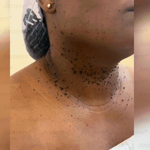 𝐉𝐚𝐬𝐬𝐞𝐞𝐦® Pokročilé neinvazivní pero s CO₂ laserem na opravu pokožky 💕 (šetrně odstraňuje bradavice, mateřská znaménka, stařecké skvrny a kožní značky - bez bolesti a rozruchu!)🌿