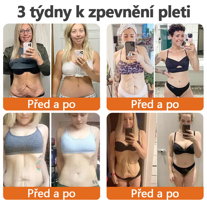Vyrobeno a odesláno z České republiky✨TLOPA® Zpevňující sérum s botoxem a včelím jedem v tyčince(🔥 POSLEDNÍ DEN SLEVA 70%)💄