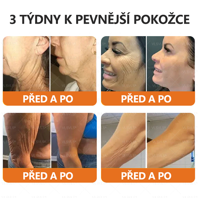 Vyrobeno a odesláno z České republiky ✨Foulme® Obnovující krém se včelím jedem ⏰ POSLEDNÍ DEN SLEVA 80%