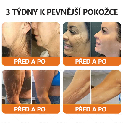 Vyrobeno a odesláno z České republiky ✨Foulme® Obnovující krém se včelím jedem ⏰ POSLEDNÍ DEN SLEVA 80%