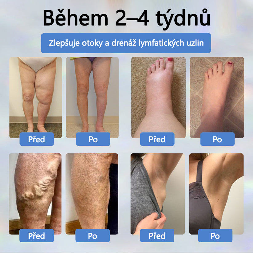 Cvreoz® Černý kmín Edema Detoxikační bylinný krém