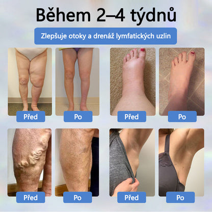 Cvreoz® Černý kmín Edema Detoxikační bylinný krém