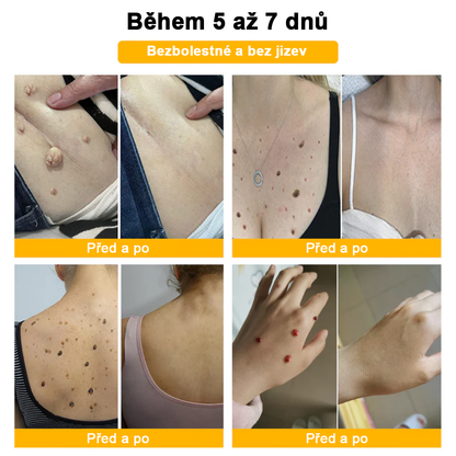 🌱🌠✨AEXZR™ Krém proti bradavicím a krtkům se včelím jedem