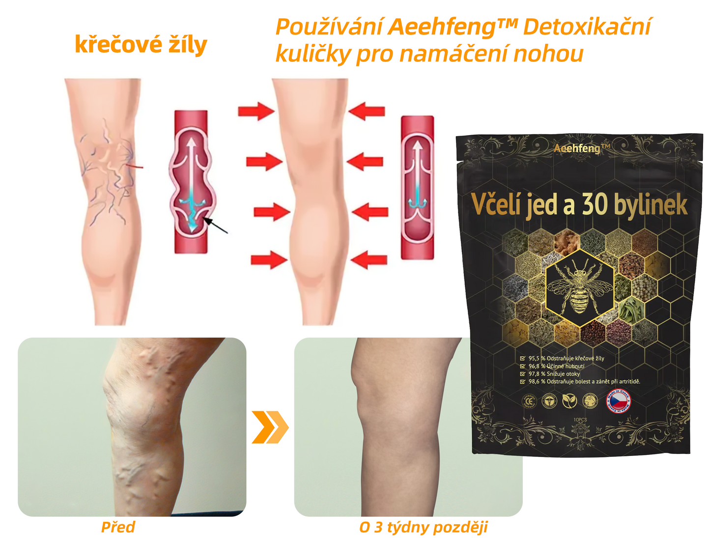 🔥💫 Poslední den na získání slevy 70 %: Aeehfeng®  Včelí jed a 30 bylinek pro detoxikaci nohou a korálky pro tvarování těla  - ✨Doporučeno Evropskou lymfatickou asociací (ELF) ✨🧀