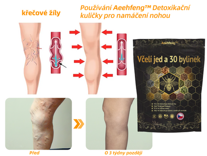 🔥💫 Poslední den na získání slevy 70 %: Aeehfeng®  Včelí jed a 30 bylinek pro detoxikaci nohou a korálky pro tvarování těla  - ✨Doporučeno Evropskou lymfatickou asociací (ELF) ✨🧀