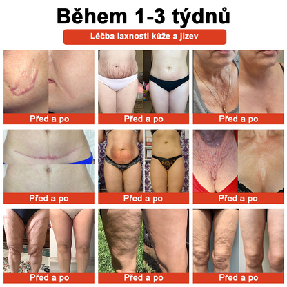 𝗦𝗧𝗗𝗘𝗜™ Zázračný luxusní tělový olej (Časově omezená sleva 80 % - poslední 1 den)🌹🔥