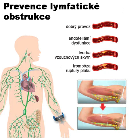 🥇 𝐉𝐎𝐒𝐅𝐈𝐓™ Ultrazvukový náramek pro odstranění celulitidy a detoxikaci organismu