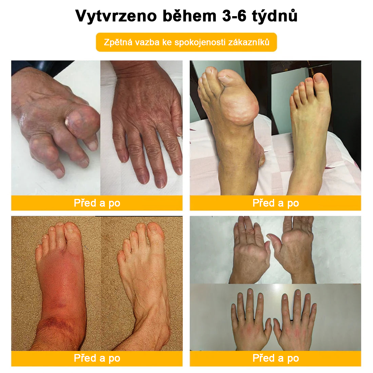 𝑭𝑨𝑻𝑶𝑵𝑮® Krém proti bolesti a hojení kostí ze včelího jedu (Výhradně pro seniory a na doporučení NVOC)🧨