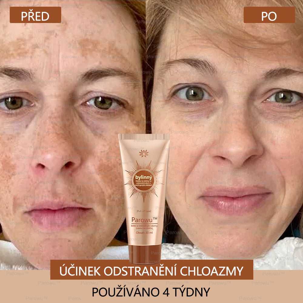 🧡Rowpin® bělící a skvrny odstraňující pleťová maska Vhodná na obličej i tělo - 👩‍⚕️ Přírodní složky trvale odstraňují stařecké skvrny, pihy, sluneční a jaterní skvrny.💥