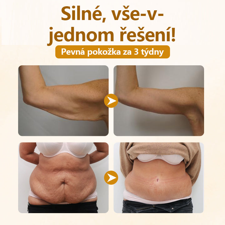 Timilk® Opravný krém s komplexem včelího jedu