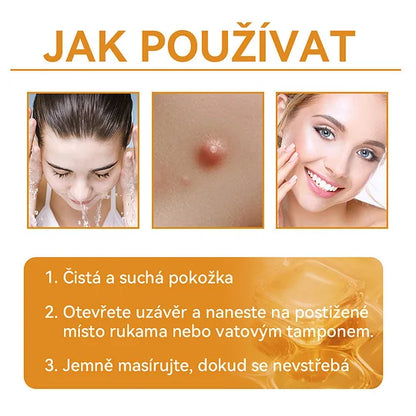 💥🔥𝐕o𝐬𝐨𝐱𝐚™ 𝐕č𝐞𝐥í𝐦 𝐉𝐞𝐝𝐞𝐦 𝐍𝐚 𝐎𝐝𝐬𝐭𝐫𝐚𝐧ě𝐧í 𝐁𝐫𝐚𝐝𝐚𝐯𝐢𝐜 𝐀 𝐙𝐧𝐚𝐦é𝐧𝐞𝐤 𝐊𝐫é𝐦🐝🐝(🔥𝐏𝐫𝐨𝐩𝐚𝐠𝐚č𝐧í 𝐚𝐤𝐜𝐞 𝐧𝐚 𝐩𝐨𝐬𝐥𝐞𝐝𝐧í 𝐝𝐞𝐧 𝟖𝟎% 𝐬𝐥𝐞𝐯𝐚)🔥💥✨